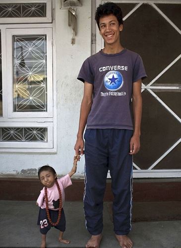 世界上最小的人，袖珍人马加尔高50厘米重4.5公斤
