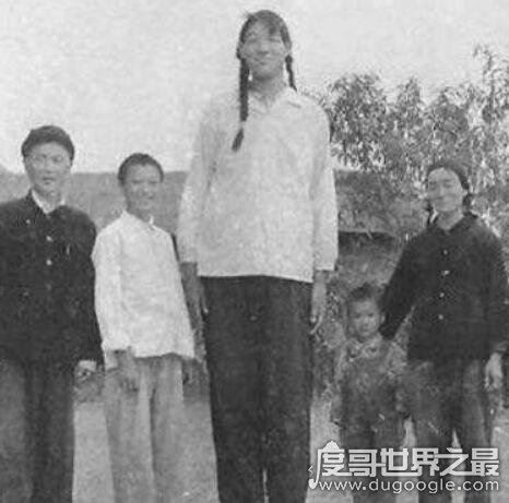 全球史上最高的女性，中国曾金莲2.48米(身患巨人症)