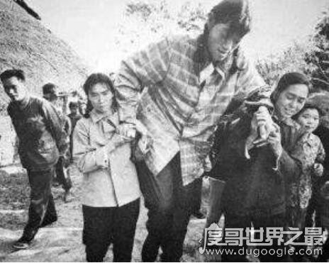 全球史上最高的女性,中国曾金莲2.48米(身患巨人症)