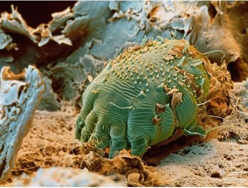 世界10大最恶心的寄生虫，龙线虫最恶心(一条长几十厘米)