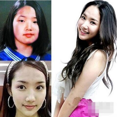 韩国女星朴敏英整容前后照片对比，丑女大翻身(整容前丑爆了)