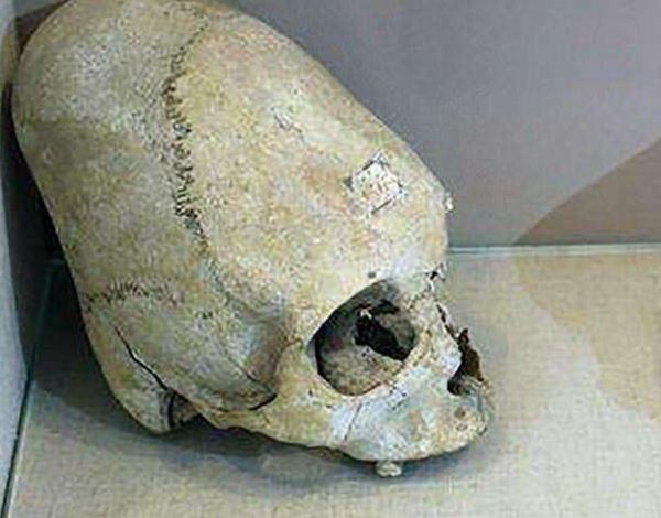 俄罗斯出土一块奇怪头骨，椭圆形像极了外星人（千年遗址）