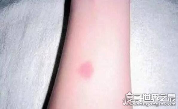 古代守宫砂是什么,守宫砂的原理揭秘(用来检测女性贞超)