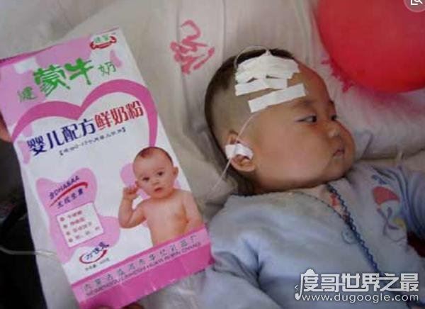 安徽阜阳大头娃娃事件，无良商家生产劣质奶粉害死无辜婴儿