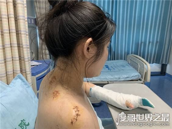 南京一女子被室友追求者捅刀，室友前往医院探望一次后失去联系
