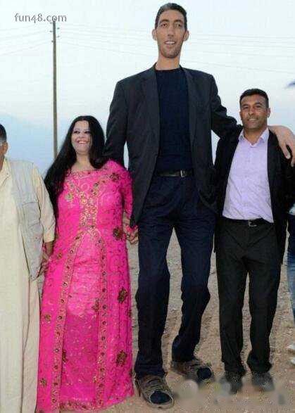 世界上最高的人，中国巨人詹世钗高达3.19米