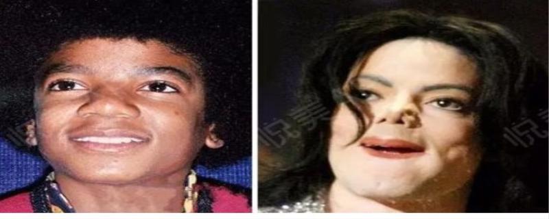 迈克尔杰克逊的鼻子怎么回事