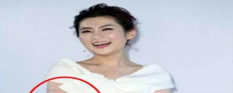 任家萱烧伤前后对比照,任家萱为什么离的婚