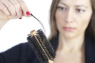 女性脱发：原因，治疗方法以及如何防止头发稀疏