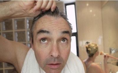 如果一个60岁的男人头发掉得很厉害 他该怎么办？