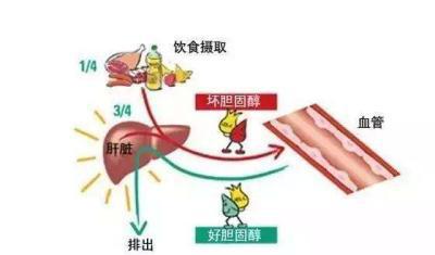 胆固醇和血脂有什么区别