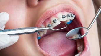 压力会影响牙齿的7种方式