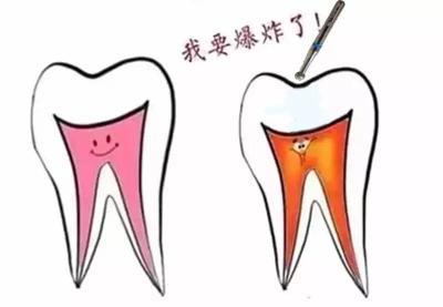 如何治疗脓肿或牙龈生疮