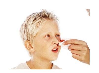 什么原因导致流鼻血，您该如何治疗？