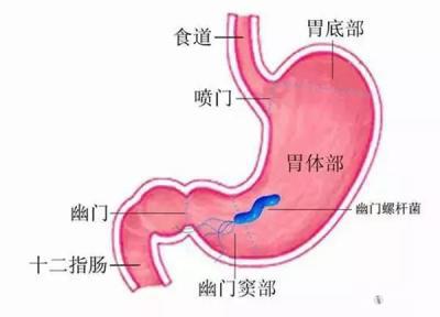 慢性胃炎养胃应该怎么做？