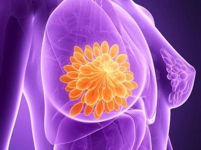 男性乳腺癌的症状是什么？