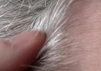 男的白头发多是肾虚吗？