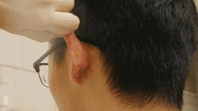 通过按摩耳朵也能达到补肾效果吗？怎样按摩补肾？