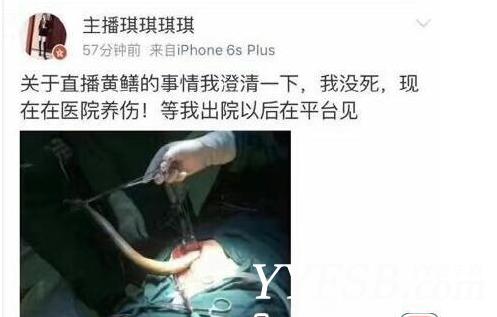 黄鳝门琪琪照片 黄鳝门女主播琪琪死了吗？