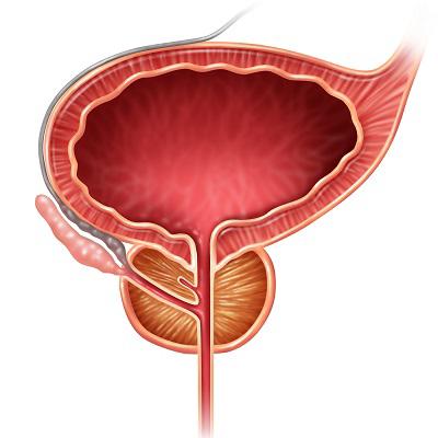 根治前列腺炎最好的方法 三个方法治疗列腺炎