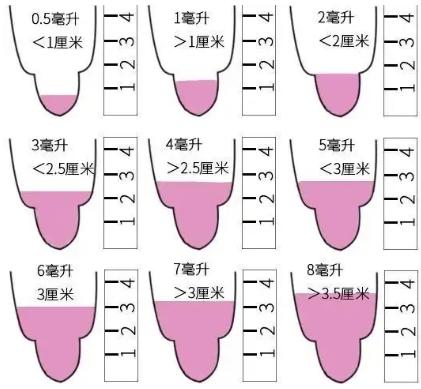 精液检查需要查什么？影响精子质量的因素