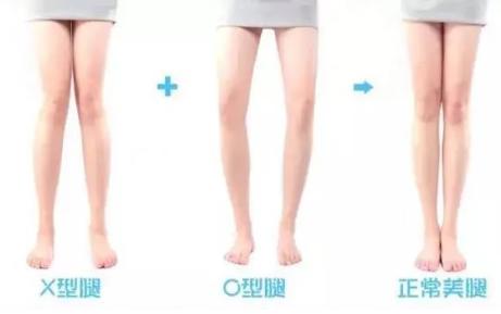 女生的双腿合不拢就意味着有性生活？别想多了……