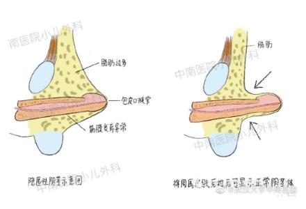 丁丁长度对女生来说重要吗？太大的烦恼你不懂……