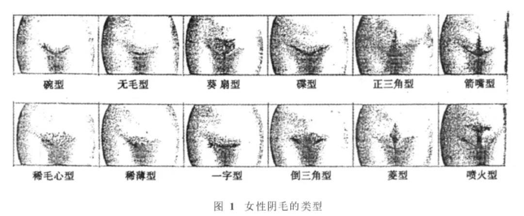 私处的毛毛到底要不要脱