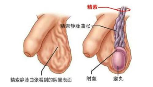 男生蛋蛋上长蚯蚓是怎么回事