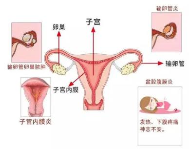 女孩子内裤总是湿哒哒 下面水太多也是一种烦恼！