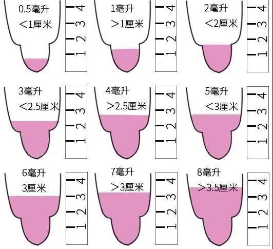 你们的「小蝌蚪」还好吗？5个方法自查下